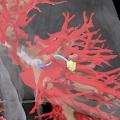 Animation: Autonome Nadel erreicht den Tumor (gelb) in der Lunge (Bild: northcarolina.edu)